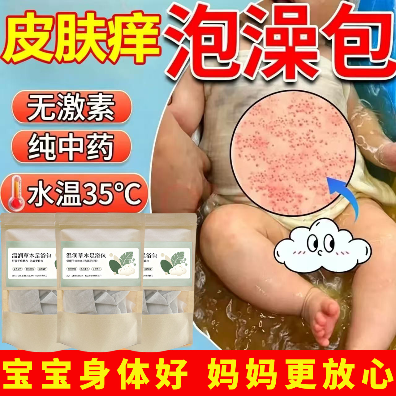 中药泡脚泡澡包缓解荨麻疹过敏