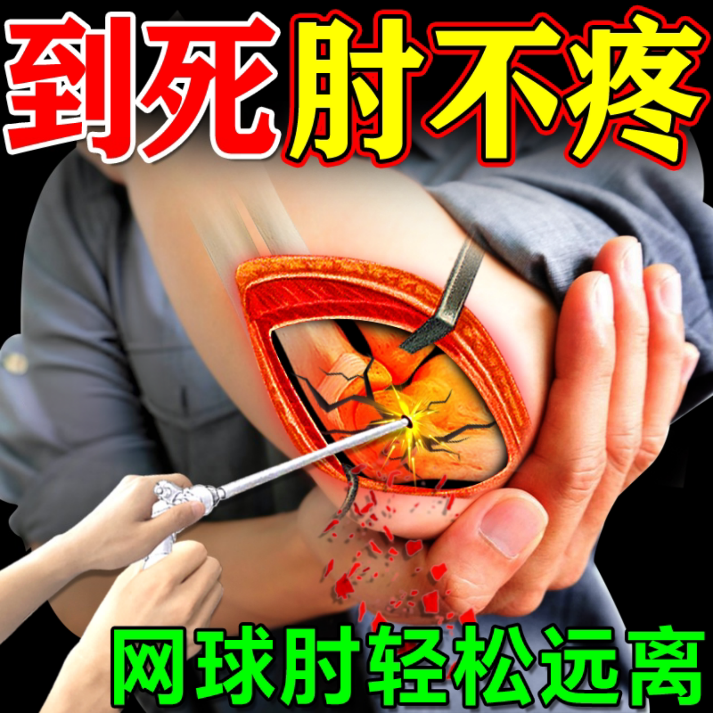 网球肘贴膏护肘外用手臂胳膊克用腱鞘关节星医生神器疼痛贴旗舰店