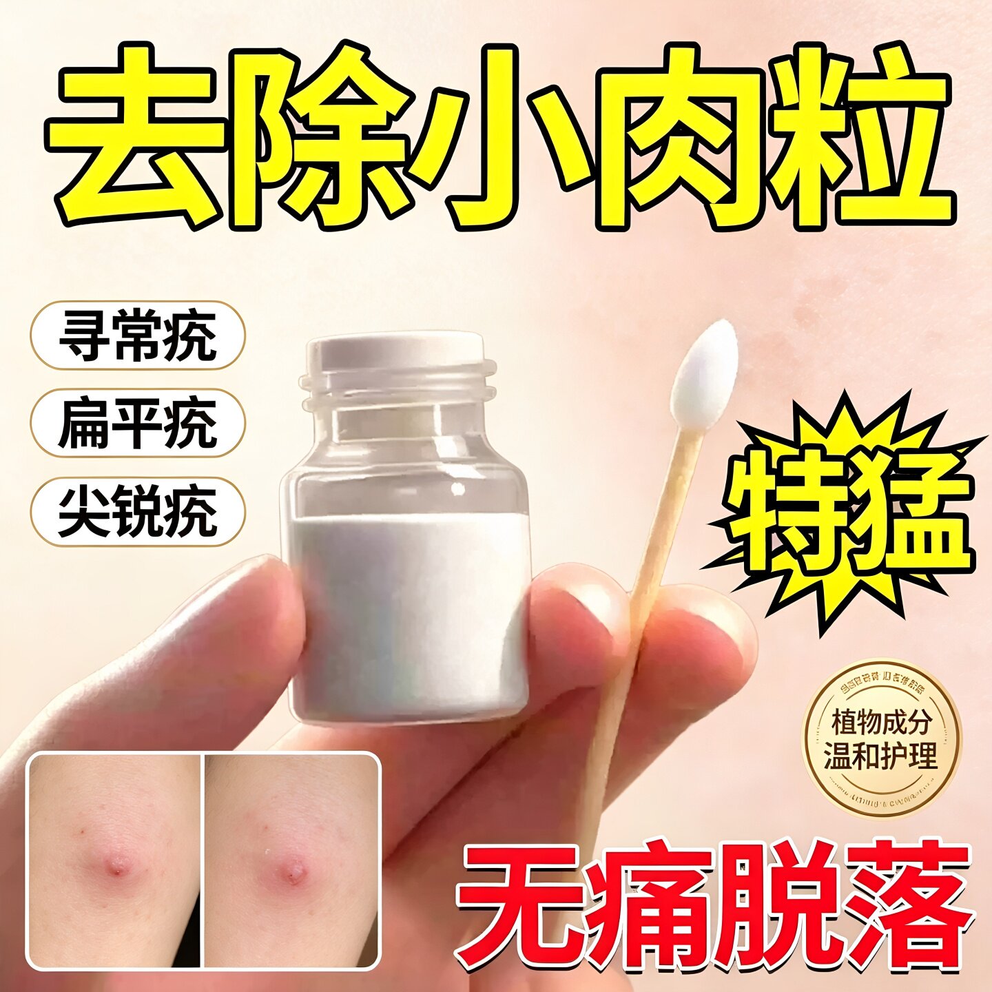 疣瘊肉痣粒一抹无忧去除扁平丝状疣疙瘩脱落立净药膏官方正旗舰店