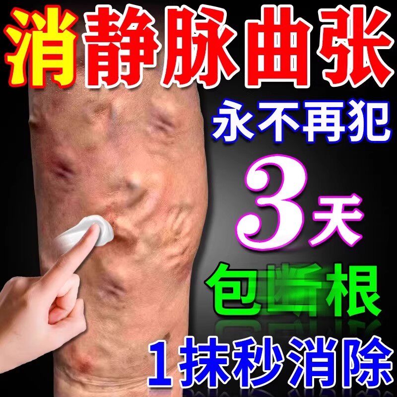 静脉曲张官方正品旗舰店