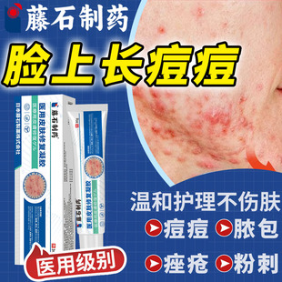 催熟痘痘结节硬块淋巴痘腮边下巴反复长痘硬疙瘩药房同售膏HT