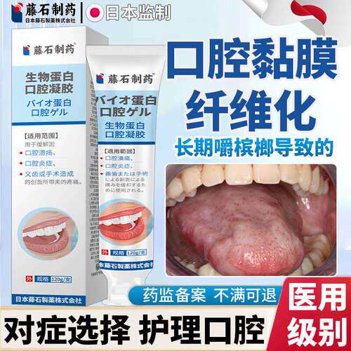 嚼槟榔口腔黏膜纤维化粘白
