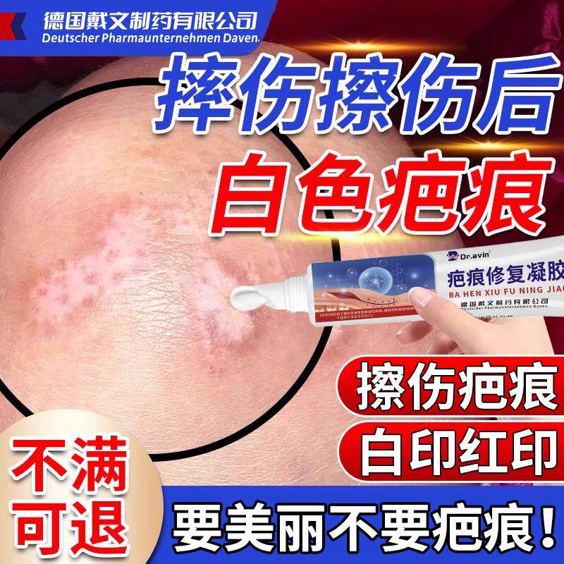 擦伤摔伤疤痕发白去白色疤痕色素脱失色脱白疤除沉着修复祛疤膏VQ