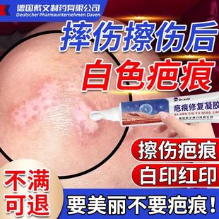 擦伤摔伤疤痕发白去白色疤痕色素脱失色脱白疤除沉着修复祛疤膏VQ