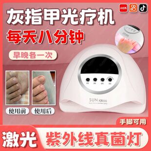 家用灰指甲光疗机紫外线抑灭菌激光真菌灯手指甲护理工具治疗仪tl