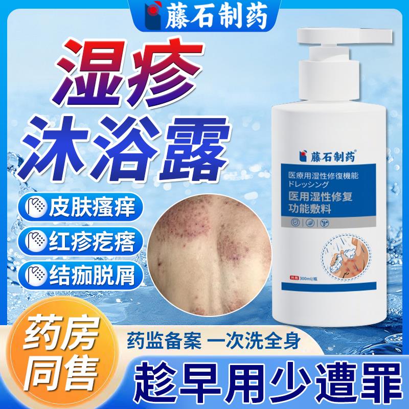 湿疹沐浴露身体乳去止痒根