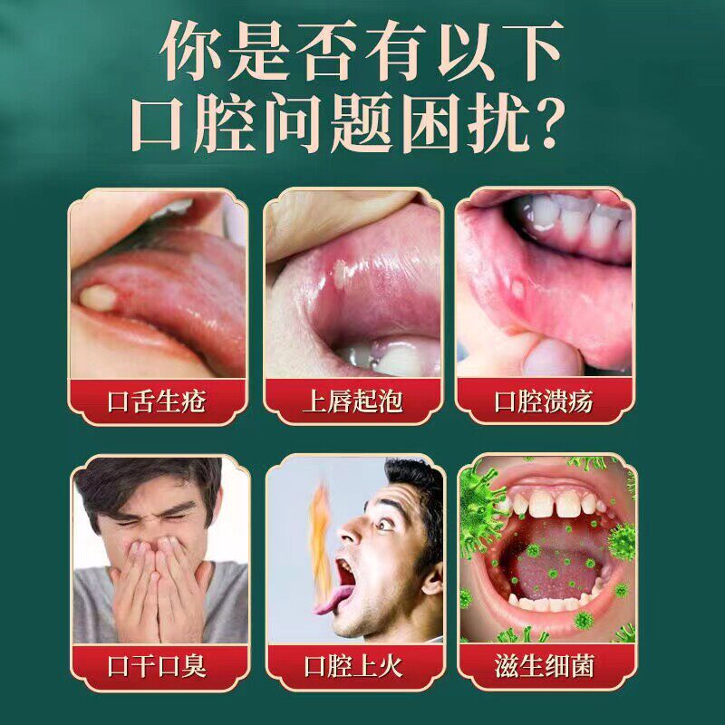 口腔溃疡美克鹿舒益生菌治疗凝胶舌头生疮起泡特效思达牙膏喷雾YF