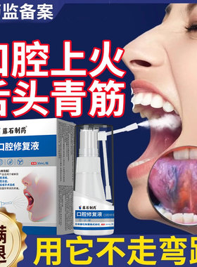 舌下青筋又黑又粗舌头底有淤血黑紫口腔炎血管堵塞溶栓液喷剂YZ