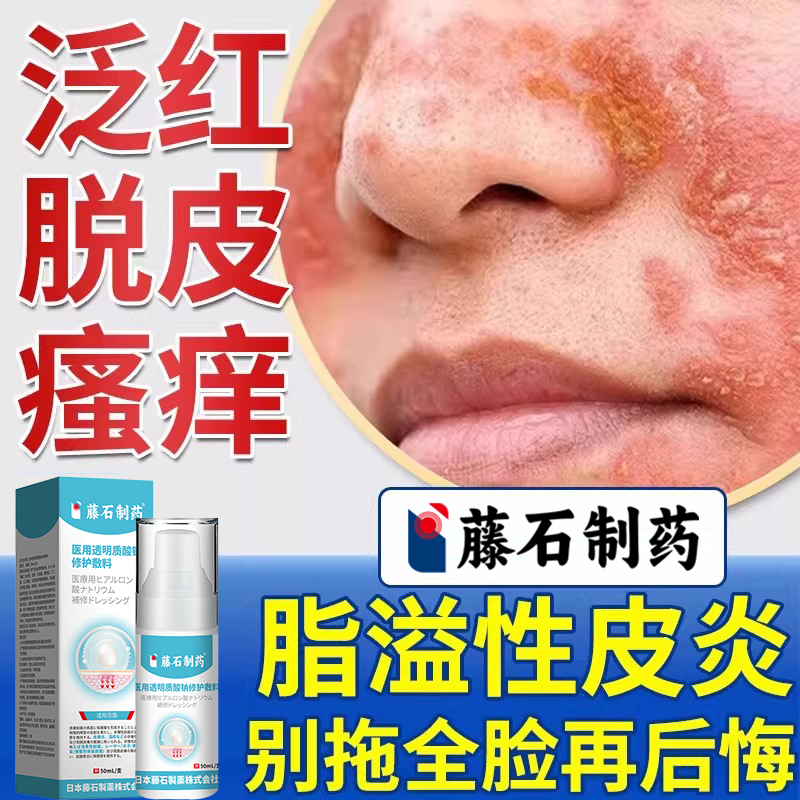 面部脂溢性皮炎鼻子翼修复