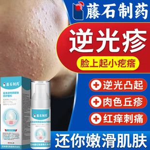 藤石制药逆光疹脸上起小疙瘩闭口粉刺屏障受损修复舒缓膏面部WQ