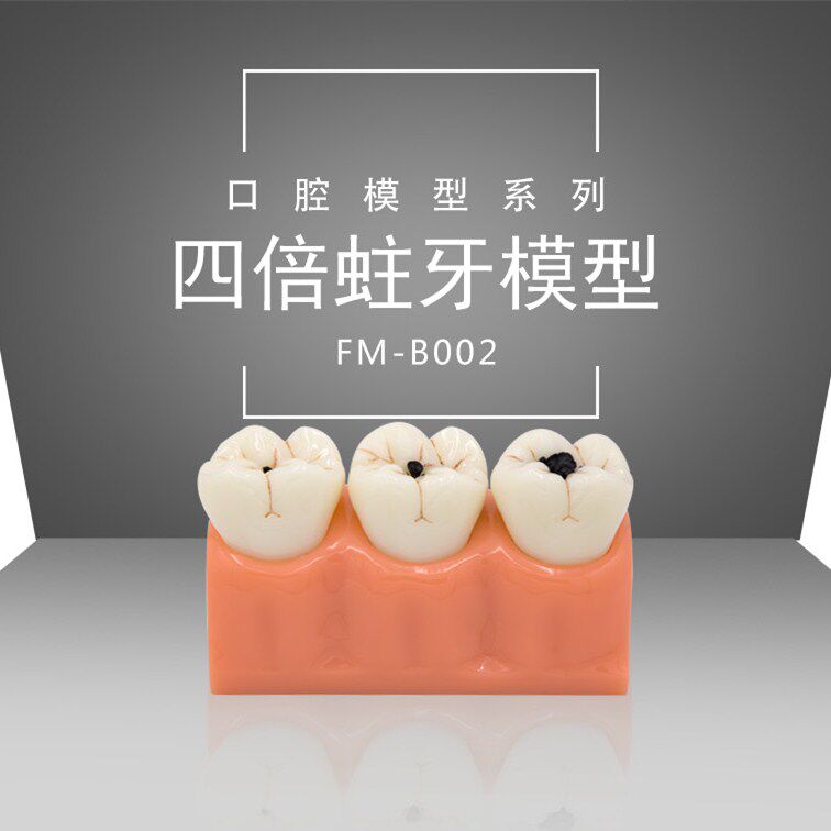 蛀牙牙齿病变四倍牙体 综合病理模型解剖齿科口腔教学沟