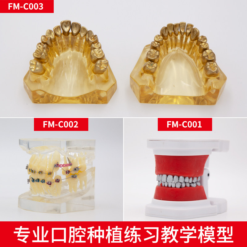 包邮牙科正畸矫正教学练习模型自锁金属陶瓷托槽模型口腔医患沟通