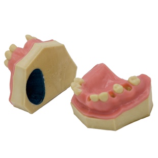 牙模口腔模型种植牙练习缺失牙上颌窦提升模型教学示教医患沟通