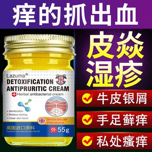 皮肤湿疹止痒外用顽固皮炎瘙痒根成人湿疹去非药特效水泡身上干燥