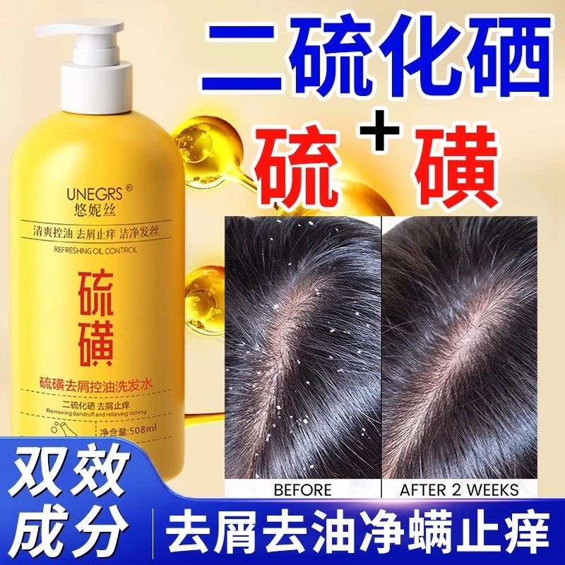 悠妮丝去屑清洁止痒洗发露蓬松