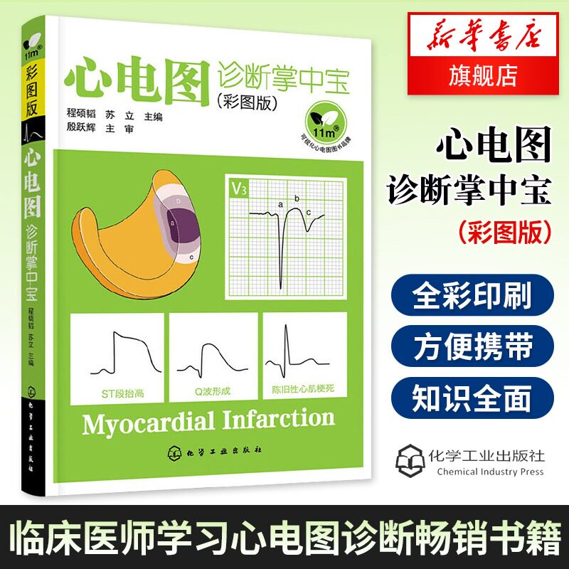心电图诊断掌中宝彩图版 临床心电图诊断心电图基本图形波段的识别