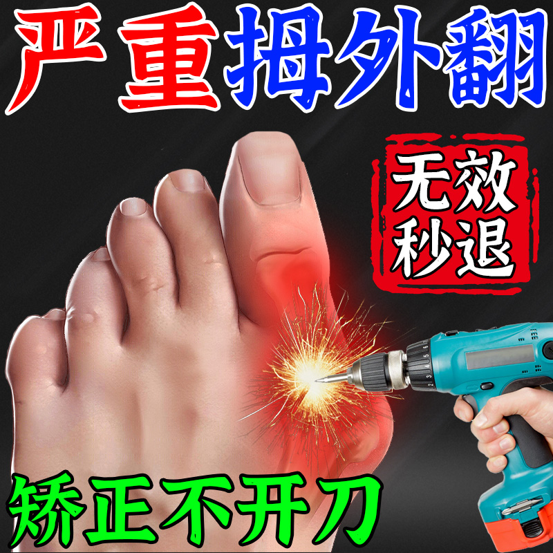 强效矫正拇外翻【再严重当晚就好