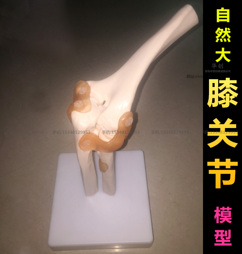 肘部模型肘关节模型桡骨人体骨骼韧带结构造模型教学模型医学教具