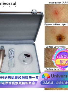 佳宜通JYtop面部UV皮肤测试仪,表皮真皮UV多功能皮肤分析仪EH3100
