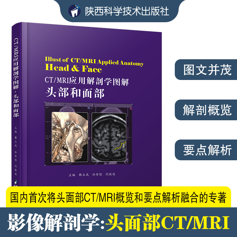 CT/MRI应用解剖学图解.头部和面部 X线扫描CT核磁共振成像MRI头面部超声诊断原理与技术图谱图解临床影像解剖学图谱影像医学书籍