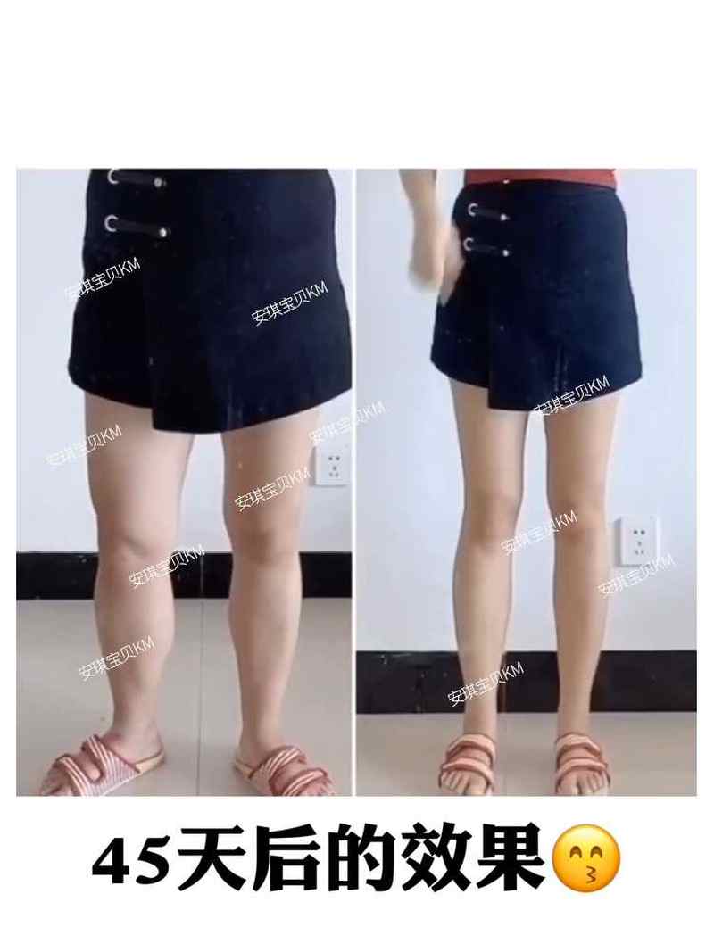 瘦腿神器大腿小腿粗腿减大象腿燃脂根部脂肪内侧赘肉肌肉消除细腿