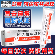 楚雅阿达帕林凝胶正品官方旗舰店痤疮粉刺祛痘去闭口痘印修复淡化