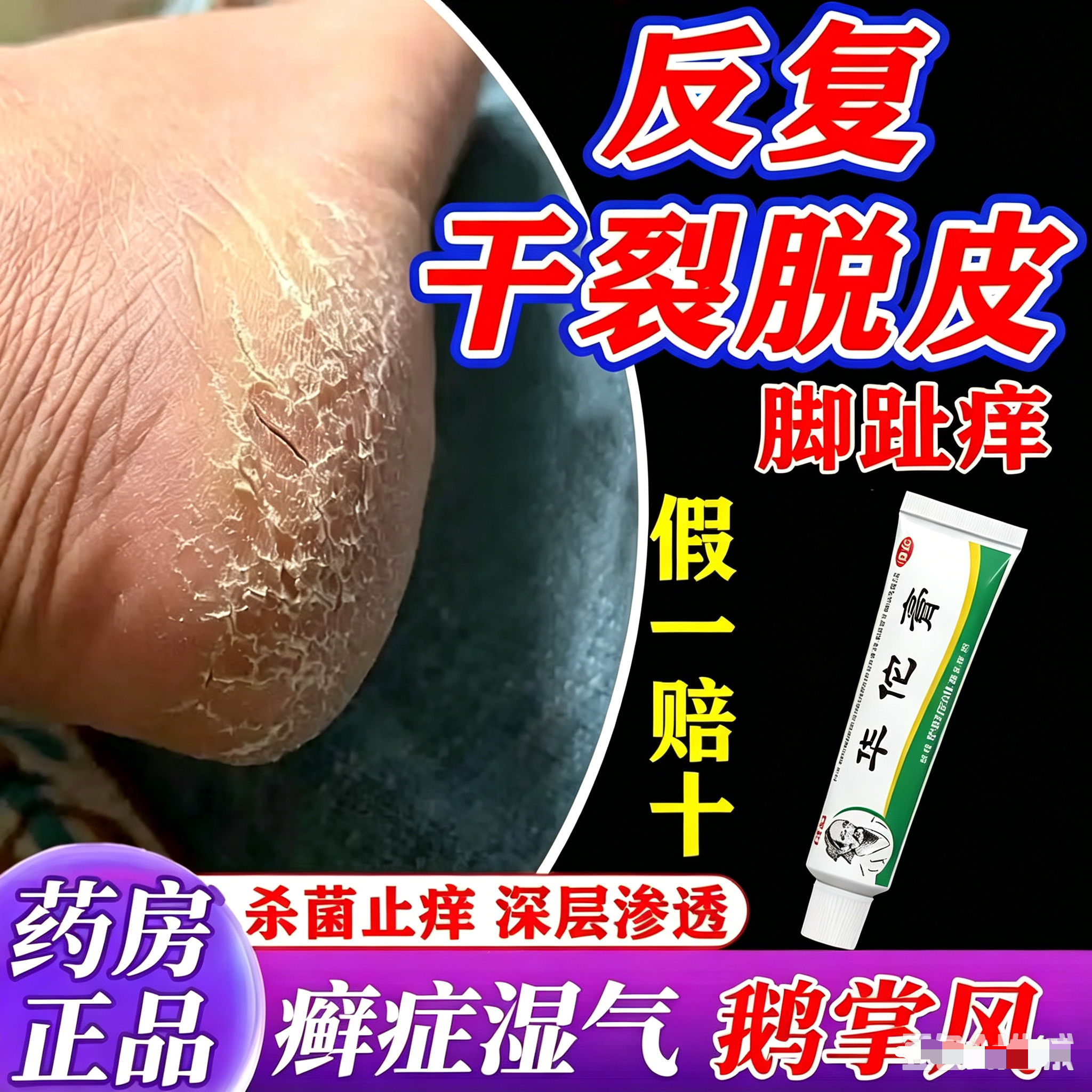 角化型脚气顽固性脚后跟真菌感染干裂脱皮特效华佗膏药官方正品