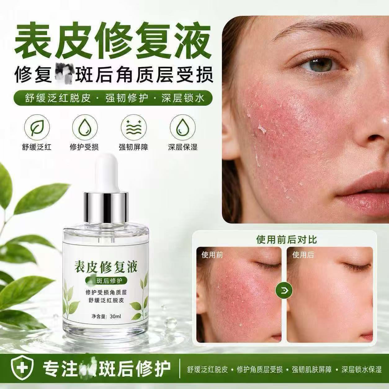 美容院专用修复液褪红修护红血丝