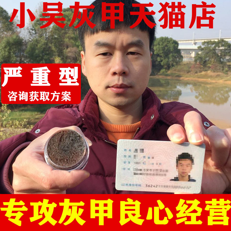 灰指甲无痛脱甲膏软甲贴实体店包扎去除增厚型灰指甲液坏旗舰店