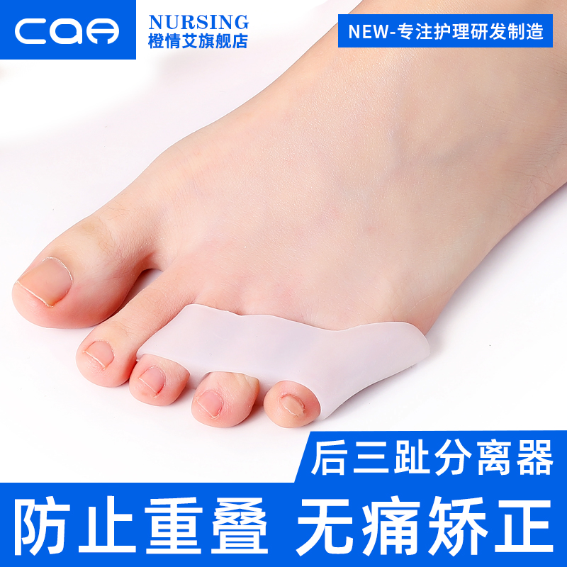 小脚趾内翻分趾器外翻外翻矫正器