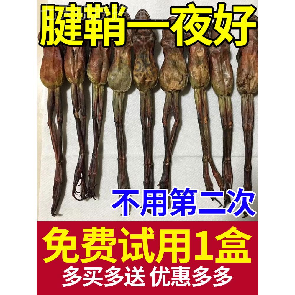 【不再疼痛】治疗腱鞘囊肿手腕鼓包腱消炎大拇指肿大腱鞘药
