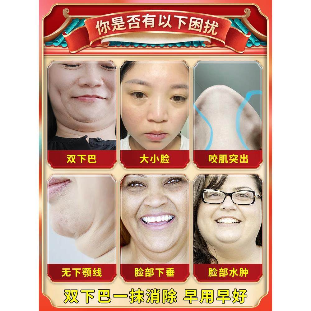 去双下巴赘肉神器瘦脖子瘦脸提拉紧致收双下巴v脸溶脂面霜去除器