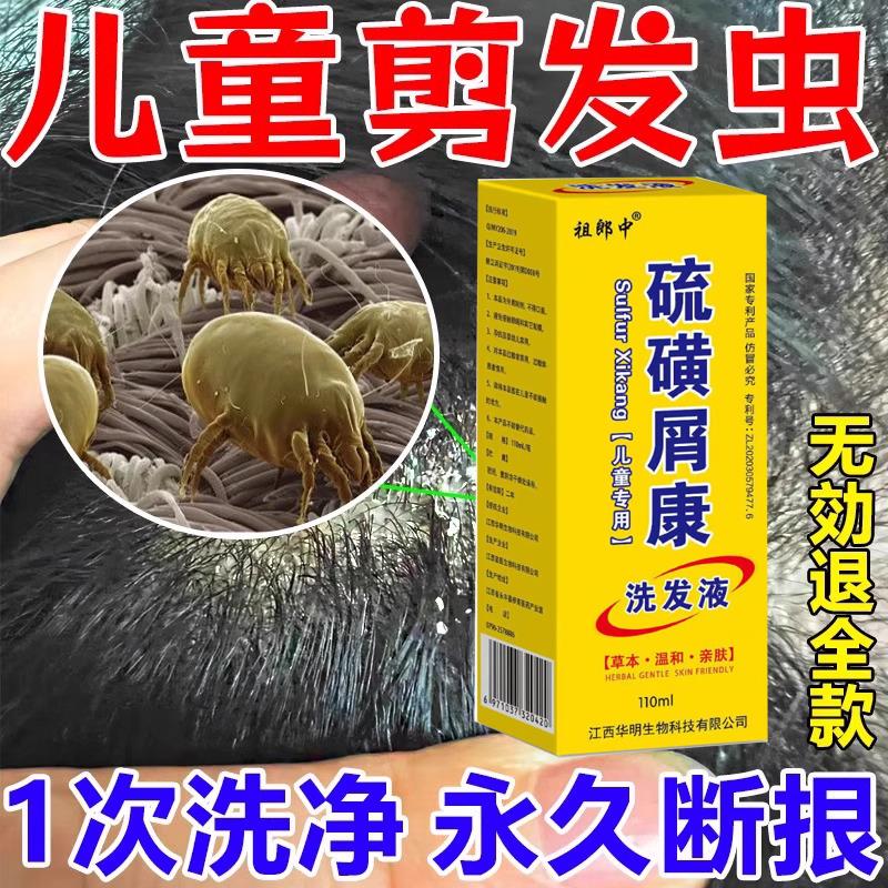 硫磺洗发水剪发虫洗发水除螨虫药儿童治小孩头上长虱子跳蚤去头屑
