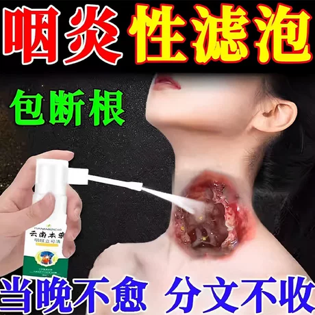 咽喉壁淋巴滤泡增生肿胀喉咙东西异物感疼痛痒干燥粘稠分泌物咳嗽