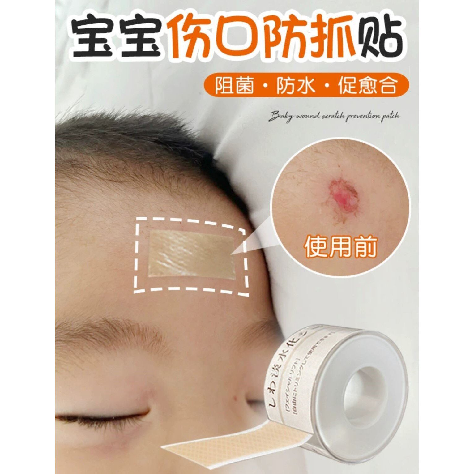 儿童隐形防抓贴 人工皮贴止血凝胶疤痕贴 宝宝伤口保护贴
