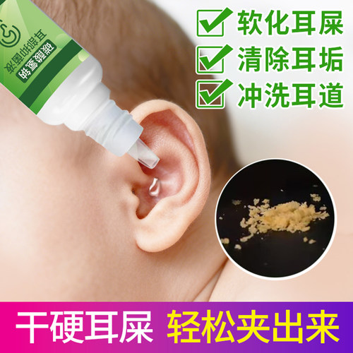 碳酸氢钠滴耳液耵聍软化耳屎清洁