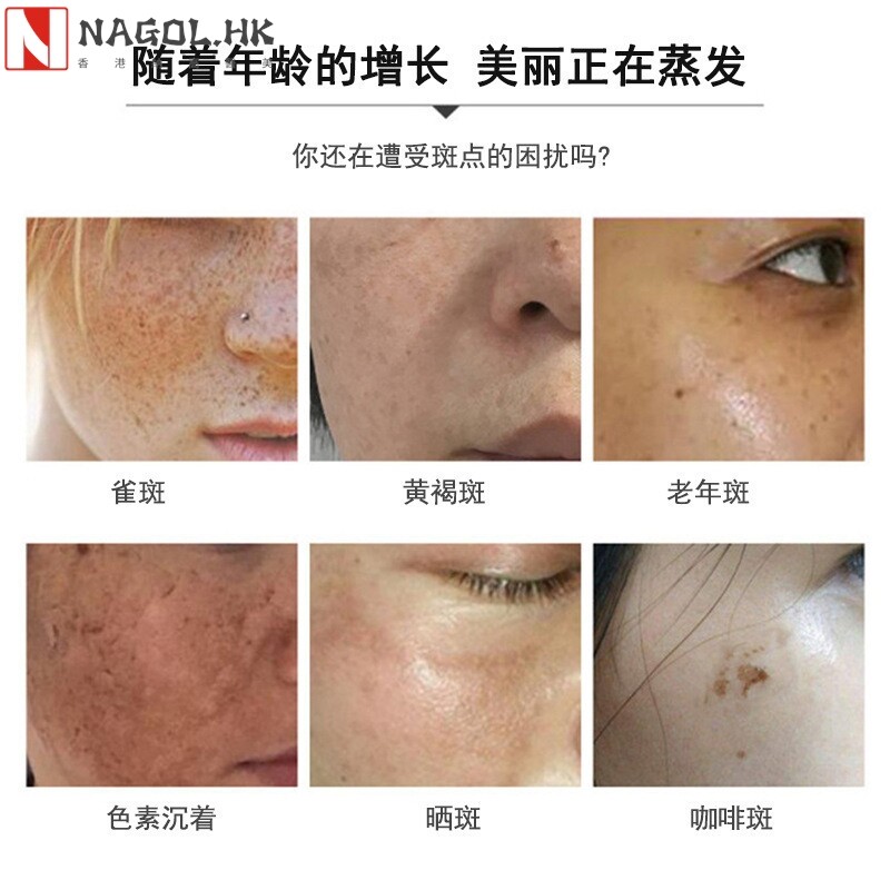 美容院臭臭水排铅汞祛黄褐斑雀斑色斑分解黑色素灯泡肌疏基水