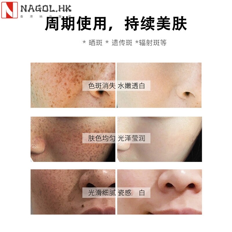无尴尬期祛斑液排色液真皮斑雀斑淡斑精华灯泡肌美白去斑液美容院