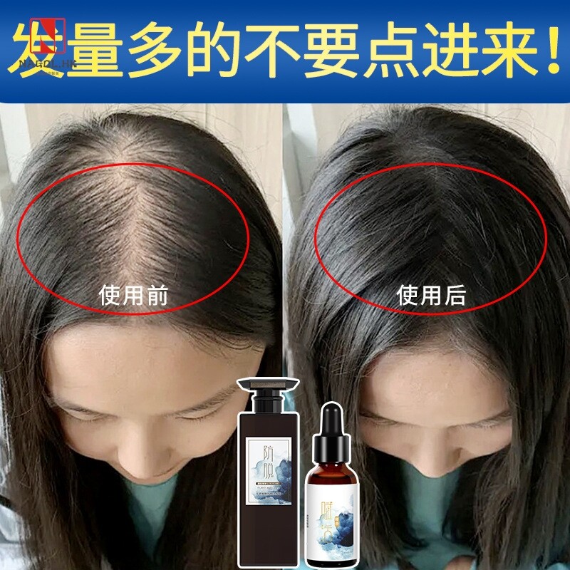 防脱育发液滋养毛囊中草本头疗养发增发密发头皮护理液洗发露