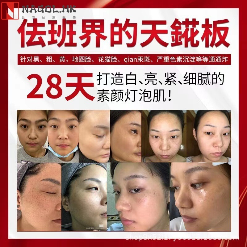 灯泡肌调肤套盒祛黄改善暗沉美白精华液去黑色素打造素颜肌美白霜