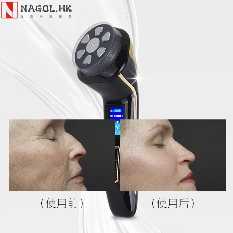 跨境热品四合一超声刀 HIFU超声刀家用祛皱纹抗皱美容仪 v脸紧至