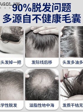 Lescolton激光生发仪低能量红光护发仪智能育发增发头盔 生发帽