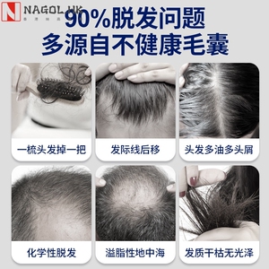 Lescolton激光生发仪低能量红光护发仪智能育发增发头盔 生发帽