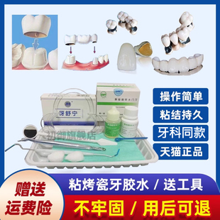 牙科自己动手粘烤瓷牙胶水牙齿钢牙套牙冠假牙专用牙科胶水粘接剂