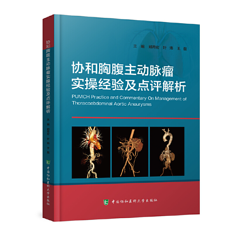 协和胸腹主动脉瘤实操经验及点评解析