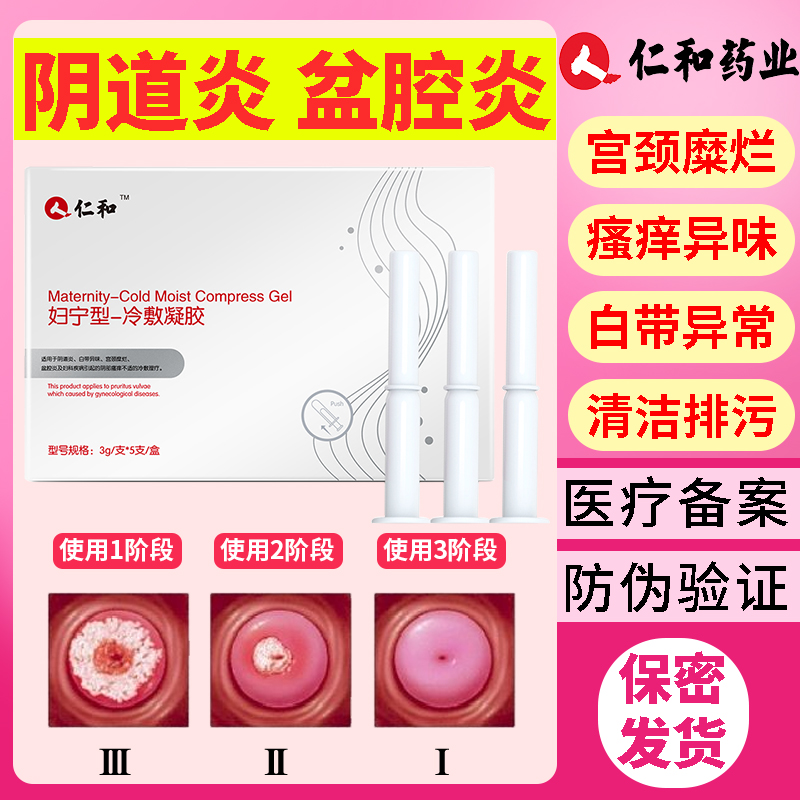 卡波姆妇科妇用凝胶霉菌性炎豆腐渣宫颈烂糜非用药女私护用品抑菌