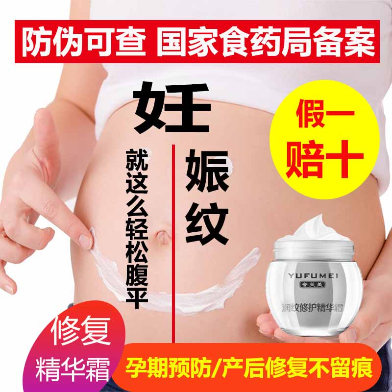 [容宜草本美妆乳液,面霜]豹纹妈妈去妊娠纹正品产后神器消除肥胖月销量2件仅售85元