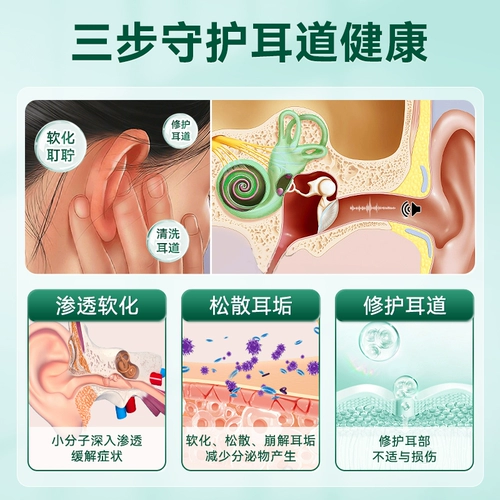 妥能 Медицинский очиститель ушной серы, шум в ушах, заложенность ушей, зуд, боль в ушах, ушные капли, официальный подлинный продукт от отита СМИ
