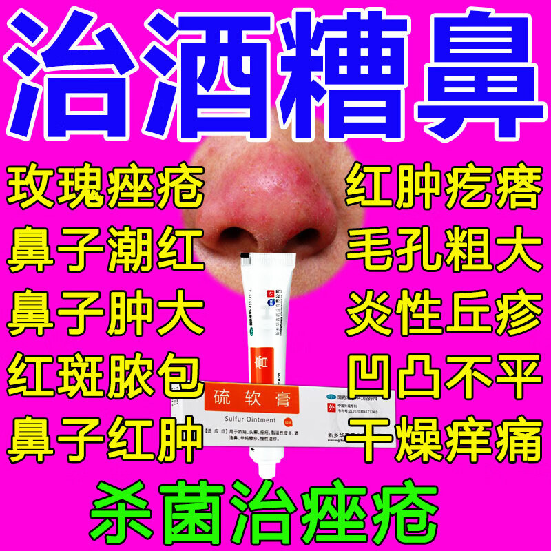 硫软膏正品官方旗舰店阴虱10g酒糟鼻专用药湿疹皮肤治疗痤疮特效