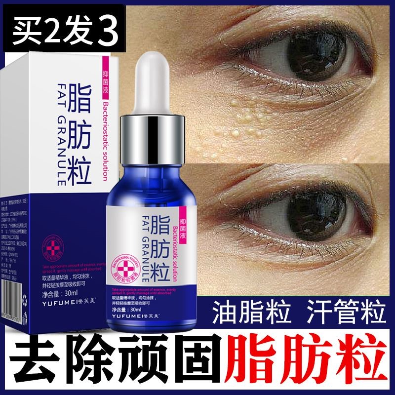 去脂肪粒眼部专用神器去除油脂粒眼睛周围汗管粒精华液眼霜